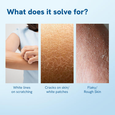 Be Bodywise 10% Urea Body Lotion 200ml | 48 Hour Dry Skin Relief | For Very Dry & Flaky Skin | With Ceramides, Kokum & Mango Seed Butter | Non-Greasy & Lightweight Formula